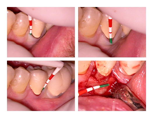 root resorption_Page1.jpg